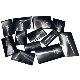 Roylco R-59269 Dental X-Rays Set of 17