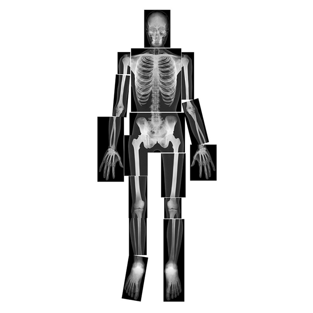 R-5911 - True To Life Human X-Rays in Human Anatomy