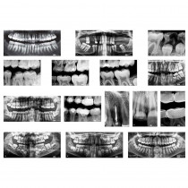 R-59269 - Dental Xrays in Human Anatomy